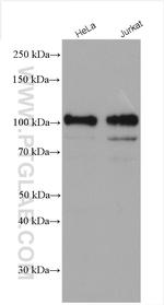 STIM2 Antibody in Western Blot (WB)