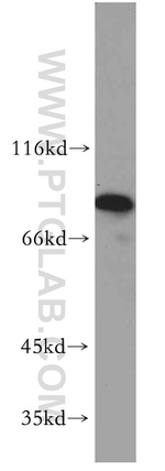 STIM2 Antibody in Western Blot (WB)