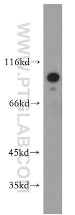 STIM2 Antibody in Western Blot (WB)