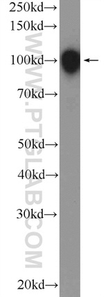 STIM2 Antibody in Western Blot (WB)