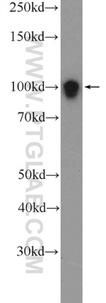 STIM2 Antibody in Western Blot (WB)