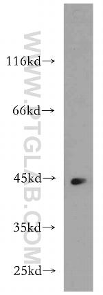 KLHL35 Antibody in Western Blot (WB)