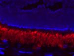 PDE6A Antibody in Immunohistochemistry (IHC)