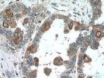 PDE6A Antibody in Immunohistochemistry (Paraffin) (IHC (P))