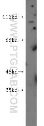 PDE6A Antibody in Western Blot (WB)