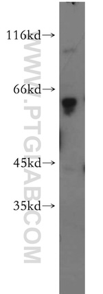 PDE6A Antibody in Western Blot (WB)