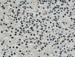 TET2 Antibody in Immunohistochemistry (Paraffin) (IHC (P))