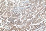 Mammaglobin B Antibody in Immunohistochemistry (Paraffin) (IHC (P))