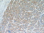 PLOD2 Antibody in Immunohistochemistry (Paraffin) (IHC (P))