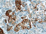 PLOD2 Antibody in Immunohistochemistry (Paraffin) (IHC (P))