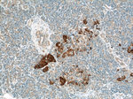 PLOD2 Antibody in Immunohistochemistry (Paraffin) (IHC (P))