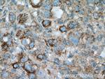 PLOD2 Antibody in Immunohistochemistry (Paraffin) (IHC (P))