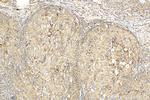 PLOD2 Antibody in Immunohistochemistry (Paraffin) (IHC (P))