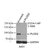 PLOD2 Antibody in Western Blot (WB)