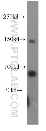 PLOD2 Antibody in Western Blot (WB)