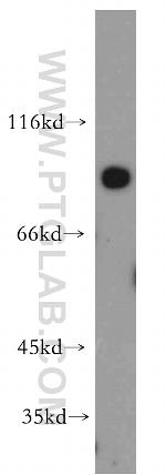 PLOD2 Antibody in Western Blot (WB)