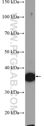 ATOH1 Antibody in Western Blot (WB)