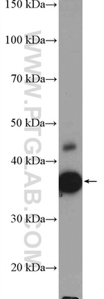 ATOH1 Antibody in Western Blot (WB)