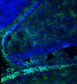 ATOH1 Antibody in Immunohistochemistry (PFA fixed) (IHC (PFA))