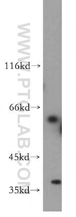 ADAD2 Antibody in Western Blot (WB)