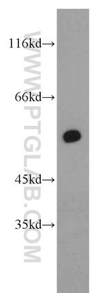 RXRA Antibody in Western Blot (WB)