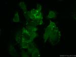 AAMP Antibody in Immunocytochemistry (ICC/IF)