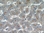 AAMP Antibody in Immunohistochemistry (Paraffin) (IHC (P))