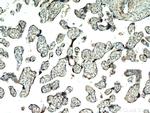 AAMP Antibody in Immunohistochemistry (Paraffin) (IHC (P))