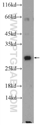 SCO2 Antibody in Western Blot (WB)