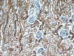 KCNQ1DN Antibody in Immunohistochemistry (Paraffin) (IHC (P))