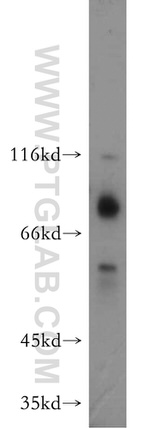 E2A Antibody in Western Blot (WB)