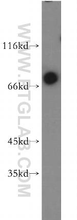 E2A Antibody in Western Blot (WB)