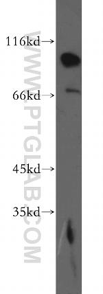 EPS15R Antibody in Western Blot (WB)