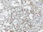 ER Antibody in Immunohistochemistry (Paraffin) (IHC (P))