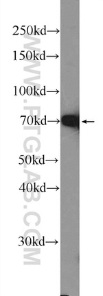 ER Antibody in Western Blot (WB)