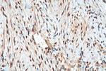 ER Antibody in Immunohistochemistry (Paraffin) (IHC (P))