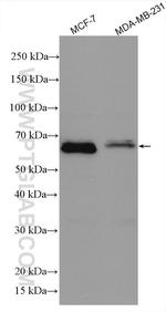 ER Antibody in Western Blot (WB)