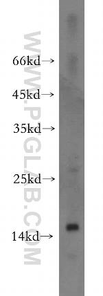 FABP2 Antibody in Western Blot (WB)