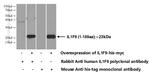 IL36 gamma Antibody in Western Blot (WB)