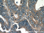 IL36 gamma Antibody in Immunohistochemistry (Paraffin) (IHC (P))