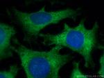 Catalase Antibody in Immunocytochemistry (ICC/IF)