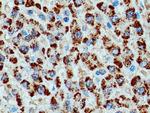 Catalase Antibody in Immunohistochemistry (Paraffin) (IHC (P))