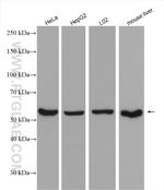 Catalase Antibody in Western Blot (WB)