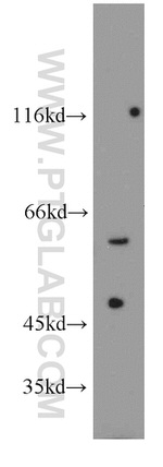 Catalase Antibody in Western Blot (WB)