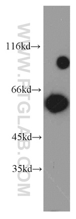 Catalase Antibody in Western Blot (WB)