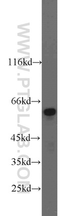 Catalase Antibody in Western Blot (WB)