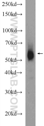 Catalase Antibody in Western Blot (WB)