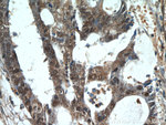 CTR9 Antibody in Immunohistochemistry (Paraffin) (IHC (P))