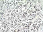 CTR9 Antibody in Immunohistochemistry (Paraffin) (IHC (P))