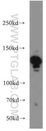 CTR9 Antibody in Western Blot (WB)